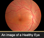 An image of a Healthy Eye